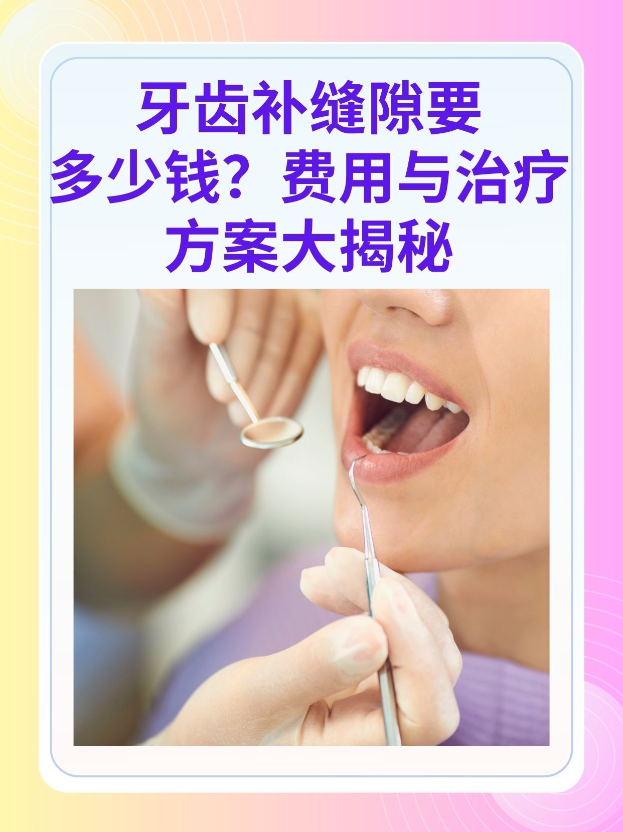 六安补牙医保可以报销吗(补牙医保可以报销吗 哪些可以报销呢)